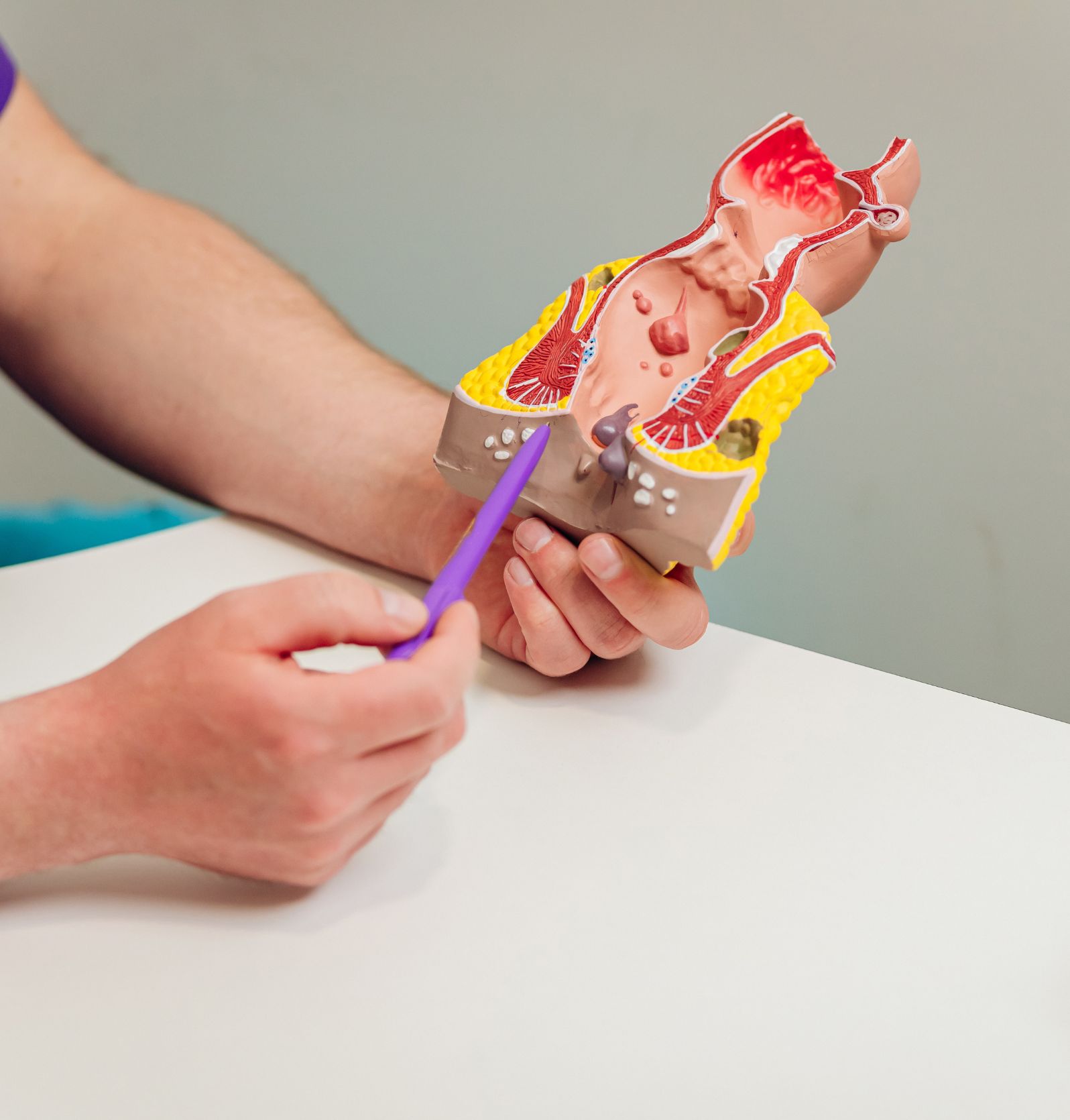 Proctology | Cáncer de ano