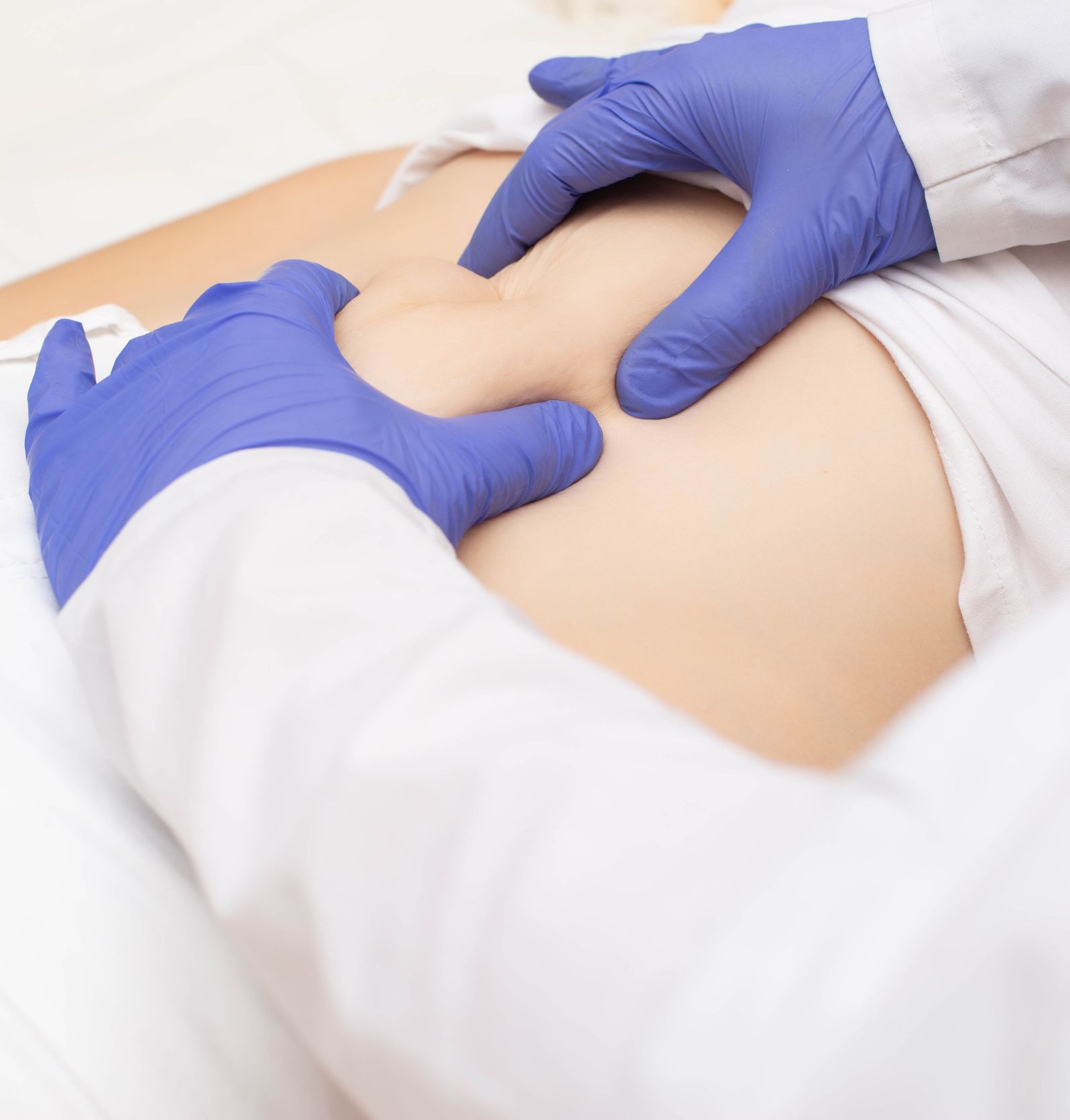 Proctology | Padecimiento | Hernias